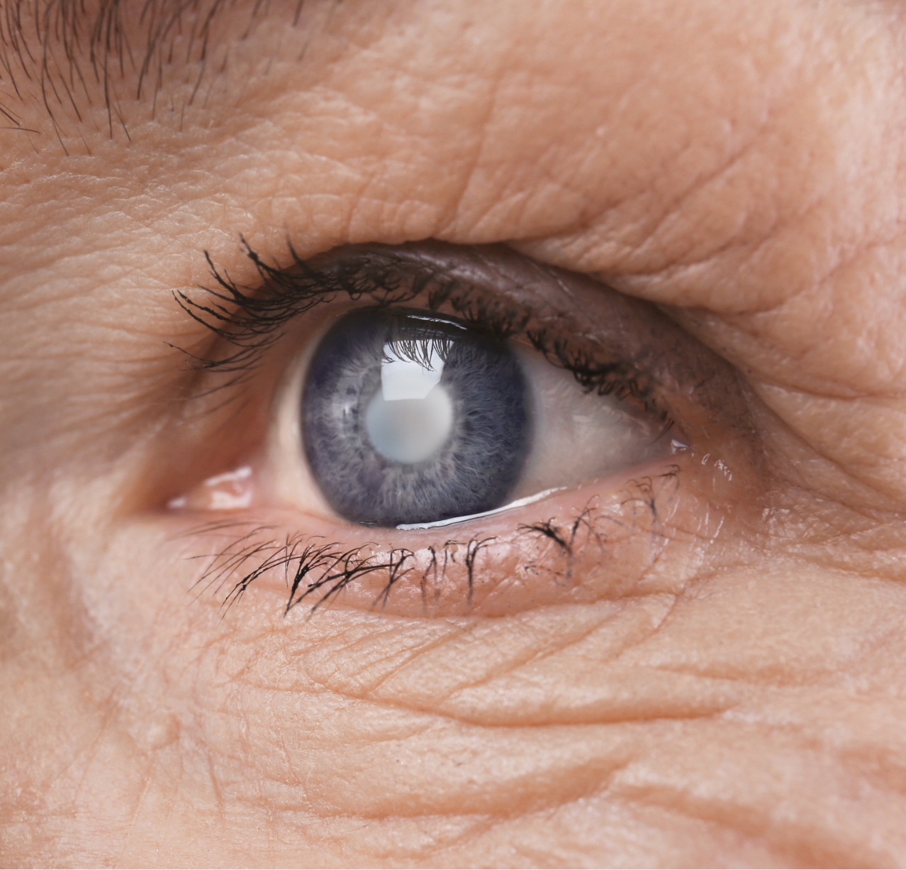 Dr Carmen Oakley – Eye Closeup